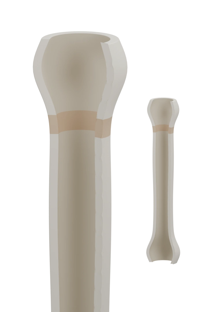 Original 3D cutaway bone-end detail with a warm growth-zone highlight and a smaller whole-bone context view at a different magnification. This conceptual model cannot show whether a person's growth plates are open.