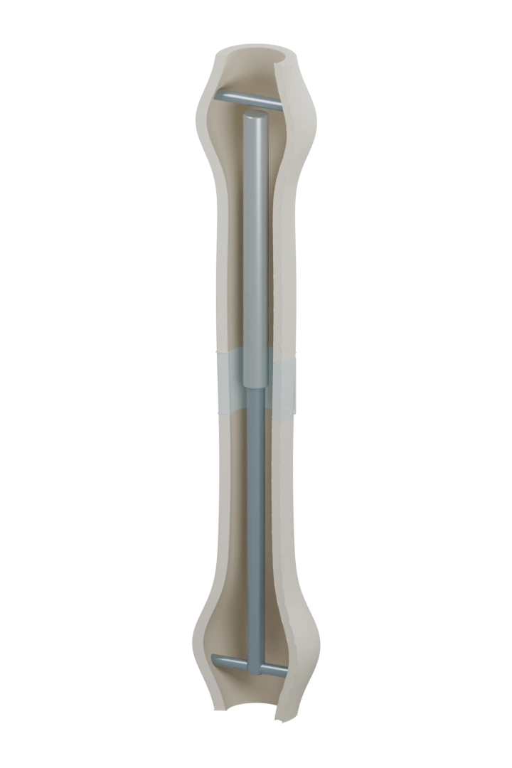 The lengthened cutaway bone has pale blue tissue bridging the gap, representing gradual mineralization while the internal nail remains.